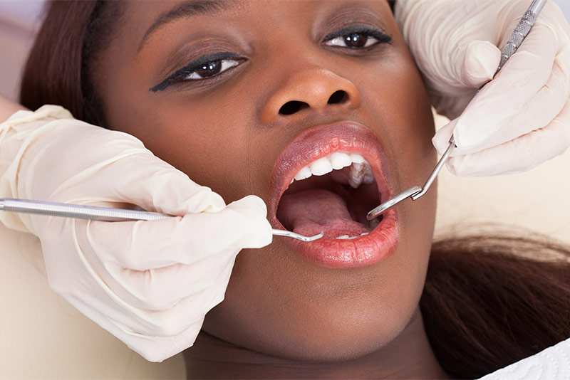 The Importance of Regular Dental Cleanings: A Comprehensive Guide Cosmo Dental, San Francisco, CA